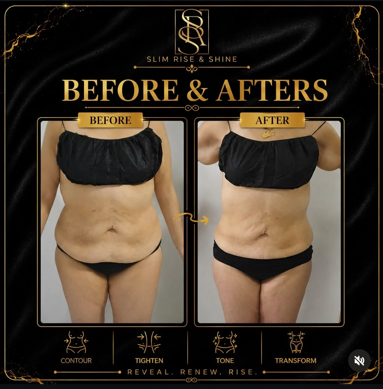 Slim Rise and Shine real client case one