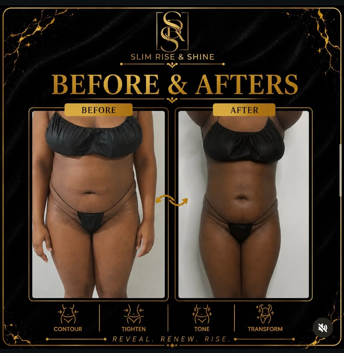 Slim Rise and Shine real client case two