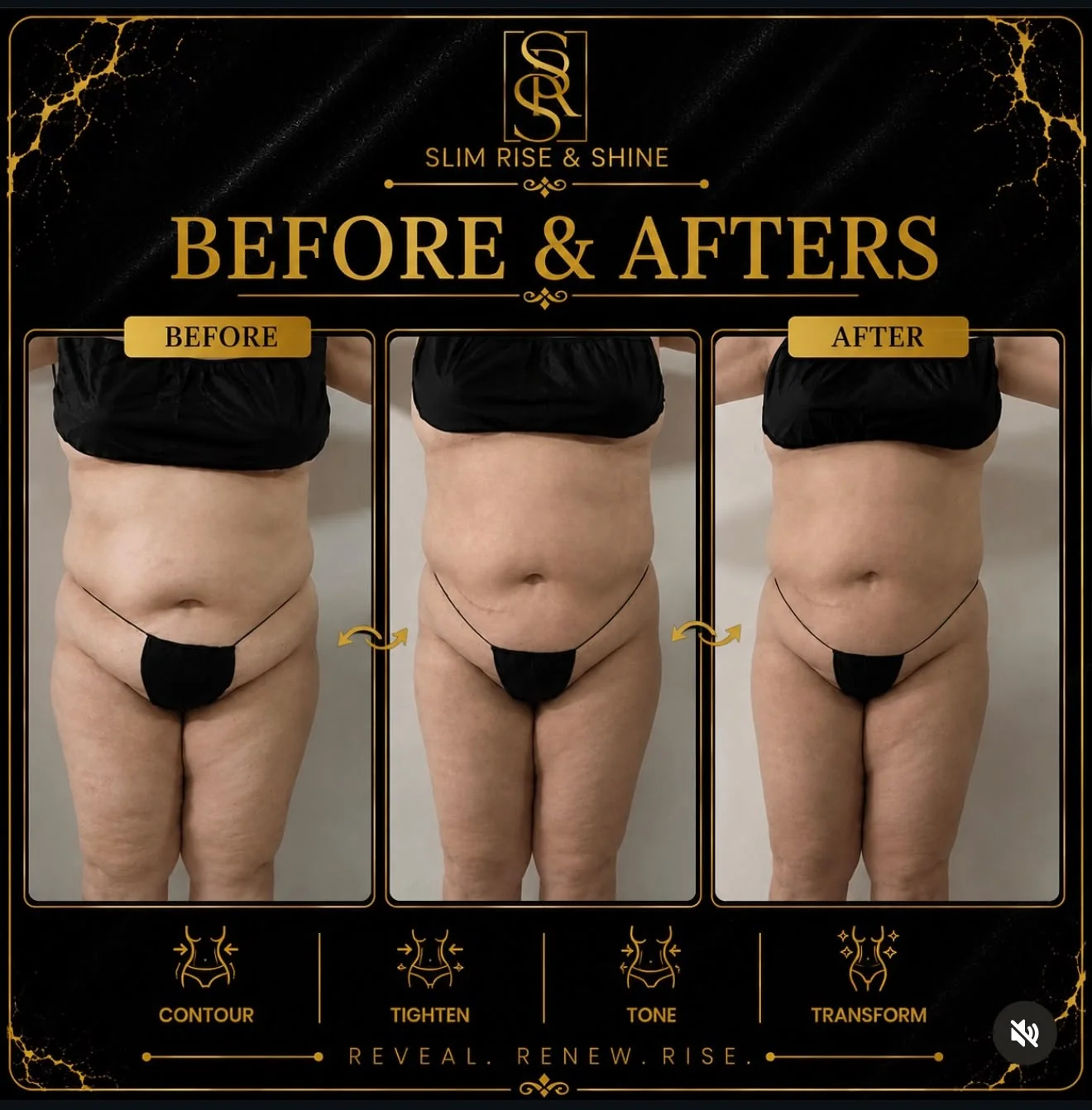 Slim Rise and Shine real client case three