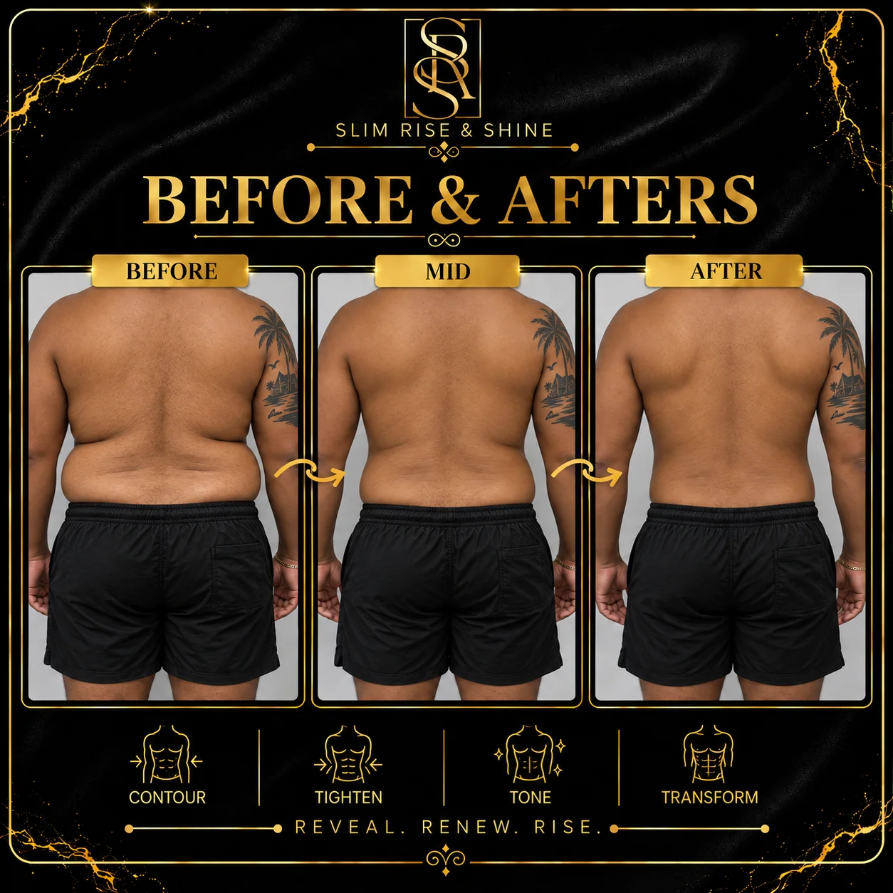 Slim Rise and Shine male contouring case 03